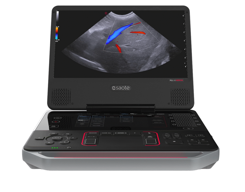 Esaote-MyLab-Heron