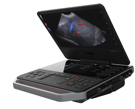 Ultrassom Esaote MyLab™ Heron